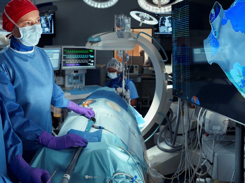 ablazione cardiaca